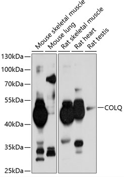 Western blot analysis of extracts of various cell lines, using COLQ antibody (TA374979) at 1:1000 dilution. - Secondary antibody: HRP Goat Anti-Rabbit IgG (H+L) at 1:10000 dilution. - Lysates/proteins: 25ug per lane. - Blocking buffer: 3% nonfat dry milk in TBST. - Detection: ECL Basic Kit . - Exposure time: 15s.