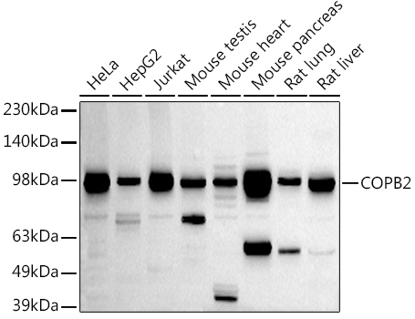 Western blot analysis of extracts of various cell lines, using COPB2 antibody (TA374988) at 1:1000 dilution. - Secondary antibody: HRP Goat Anti-Rabbit IgG (H+L) at 1:10000 dilution. - Lysates/proteins: 25ug per lane. - Blocking buffer: 3% nonfat dry milk in TBST. - Detection: ECL Basic Kit . - Exposure time: 180s.