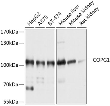 Western blot analysis of extracts of various cell lines, using COPG1 antibody (TA374990) at 1:1000 dilution. - Secondary antibody: HRP Goat Anti-Rabbit IgG (H+L) at 1:10000 dilution. - Lysates/proteins: 25ug per lane. - Blocking buffer: 3% nonfat dry milk in TBST. - Detection: ECL Basic Kit . - Exposure time: 1s.