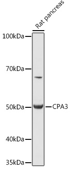 Western blot analysis of extracts of Rat pancreas, using CPA3 antibody (TA375025) at 1:1000 dilution. - Secondary antibody: HRP Goat Anti-Rabbit IgG (H+L) at 1:10000 dilution. - Lysates/proteins: 25ug per lane. - Blocking buffer: 3% nonfat dry milk in TBST. - Detection: ECL Basic Kit . - Exposure time: 1s.