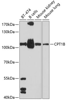 Western blot analysis of extracts of various cell lines, using CPT1B antibody (TA375055) at 1:1000 dilution. - Secondary antibody: HRP Goat Anti-Rabbit IgG (H+L) at 1:10000 dilution. - Lysates/proteins: 25ug per lane. - Blocking buffer: 3% nonfat dry milk in TBST. - Detection: ECL Basic Kit . - Exposure time: 60s.
