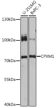 Western blot analysis of extracts of various cell lines, using CPXM1 antibody (TA375060) at 1:1000 dilution. - Secondary antibody: HRP Goat Anti-Rabbit IgG (H+L) at 1:10000 dilution. - Lysates/proteins: 25ug per lane. - Blocking buffer: 3% nonfat dry milk in TBST. - Detection: ECL Basic Kit . - Exposure time: 200s.