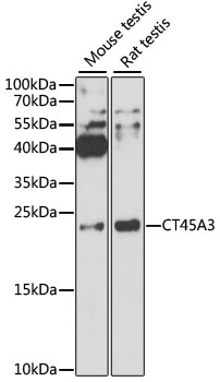 HEK293T cells were transfected with the pCMV6-ENTRY control (Cat# PS100001, Left lane) or pCMV6-ENTRY NR0B2 (Cat# RC206422, Right lane) cDNA for 48 hrs and lysed. Equivalent amounts of cell lysates (5 ug per lane) were separated by SDS-PAGE and immunoblotted with anti-NR0B2(Cat# TA806321). Positive lysates [LY402893] (100 ug) and [LC402893] (20 ug) can be purchased separately from OriGene.