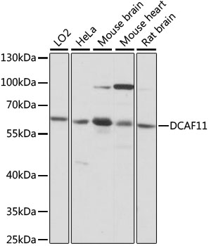 Western blot analysis of extracts of various cell lines, using DCAF11 antibody (TA375338) at 1:1000 dilution. - Secondary antibody: HRP Goat Anti-Rabbit IgG (H+L) at 1:10000 dilution. - Lysates/proteins: 25ug per lane. - Blocking buffer: 3% nonfat dry milk in TBST. - Detection: ECL Basic Kit . - Exposure time: 1s.