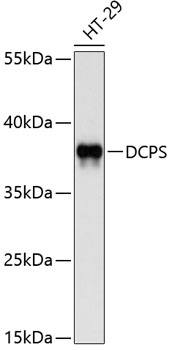 HEK293T cells were transfected with the pCMV6-ENTRY control (Left lane) or pCMV6-ENTRY NR2F6 (RC201336, Right lane) cDNA for 48 hrs and lysed. Equivalent amounts of cell lysates (5 ug per lane) were separated by SDS-PAGE and immunoblotted with anti-NR2F6. Positive lysates LY401603 (100 ug) and LC401603 (20 ug) can be purchased separately from OriGene.