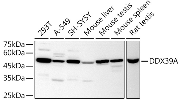 HEK293T cells were transfected with the pCMV6-ENTRY control (Left lane) or pCMV6-ENTRY PDCD1 (RC210364, Right lane) cDNA for 48 hrs and lysed. Equivalent amounts of cell lysates (5 ug per lane) were separated by SDS-PAGE and immunoblotted with anti-PDCD1. Positive lysates LY401555 (100 ug) and LC401555 (20 ug) can be purchased separately from OriGene.