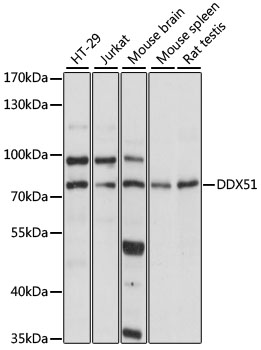 Western blot analysis of extracts of various cell lines, using DDX51 antibody (TA375403) at 1:1000 dilution. - Secondary antibody: HRP Goat Anti-Rabbit IgG (H+L) at 1:10000 dilution. - Lysates/proteins: 25ug per lane. - Blocking buffer: 3% nonfat dry milk in TBST. - Detection: ECL Basic Kit . - Exposure time: 5s.