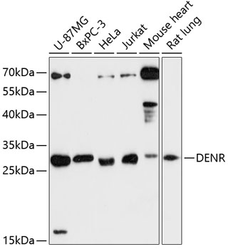 Western blot analysis of extracts of various cell lines, using DENR antibody (TA375418) at 1:3000 dilution. - Secondary antibody: HRP Goat Anti-Rabbit IgG (H+L) at 1:10000 dilution. - Lysates/proteins: 25ug per lane. - Blocking buffer: 3% nonfat dry milk in TBST. - Detection: ECL Enhanced Kit . - Exposure time: 90s.