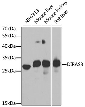 Western blot analysis of extracts of various cell lines, using DIRAS3 antibody (TA375474) at 1:1000 dilution. - Secondary antibody: HRP Goat Anti-Rabbit IgG (H+L) at 1:10000 dilution. - Lysates/proteins: 25ug per lane. - Blocking buffer: 3% nonfat dry milk in TBST. - Detection: ECL Basic Kit . - Exposure time: 90s.