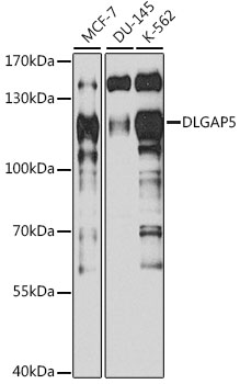 Western blot analysis of extracts of various cell lines, using DLGAP5 antibody (TA375496) at 1:1000 dilution. - Secondary antibody: HRP Goat Anti-Mouse IgG (H+L) (AS003) at 1:10000 dilution. - Lysates/proteins: 25ug per lane. - Blocking buffer: 3% nonfat dry milk in TBST. - Detection: ECL Basic Kit . - Exposure time: 90s.