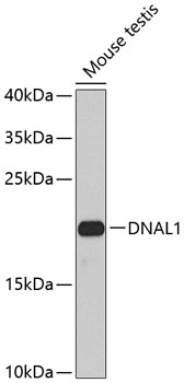 Western blot analysis of extracts of mouse testis, using DNAL1 antibody (TA375541) at 1:1000 dilution. - Secondary antibody: HRP Goat Anti-Rabbit IgG (H+L) at 1:10000 dilution. - Lysates/proteins: 25ug per lane. - Blocking buffer: 3% nonfat dry milk in TBST. - Detection: ECL Basic Kit . - Exposure time: 90s.