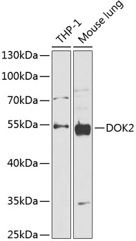 Western blot analysis of extracts of various cell lines, using DOK2 antibody (TA375580) at 1:1000 dilution. - Secondary antibody: HRP Goat Anti-Rabbit IgG (H+L) at 1:10000 dilution. - Lysates/proteins: 25ug per lane. - Blocking buffer: 3% nonfat dry milk in TBST. - Detection: ECL Basic Kit . - Exposure time: 30s.
