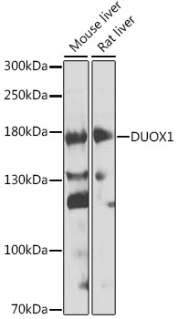 Western blot analysis of extracts of various cell lines, using DUOX1 antibody (TA375646) at 1:1000 dilution. - Secondary antibody: HRP Goat Anti-Rabbit IgG (H+L) at 1:10000 dilution. - Lysates/proteins: 25ug per lane. - Blocking buffer: 3% nonfat dry milk in TBST. - Detection: ECL Enhanced Kit . - Exposure time: 60s.