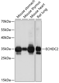 Western blot analysis of extracts (35 ug) from 3 different cell lines and 5 different tissue lysates by using anti-SFRP2 monoclonal antibody (1:500).
