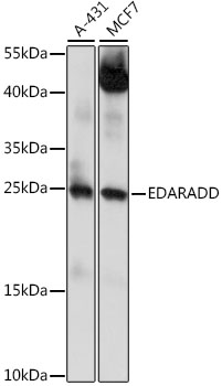 Western blot analysis of extracts of various cell lines, using EDARADD antibody (TA375706) at 1:1000 dilution. - Secondary antibody: HRP Goat Anti-Rabbit IgG (H+L) at 1:10000 dilution. - Lysates/proteins: 25ug per lane. - Blocking buffer: 3% nonfat dry milk in TBST. - Detection: ECL Basic Kit . - Exposure time: 60s.