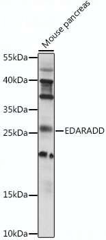 Western blot analysis of extracts of mouse pancreas, using EDARADD antibody (TA375707) at 1:1000 dilution. - Secondary antibody: HRP Goat Anti-Rabbit IgG (H+L) at 1:10000 dilution. - Lysates/proteins: 25ug per lane. - Blocking buffer: 3% nonfat dry milk in TBST. - Detection: ECL Basic Kit . - Exposure time: 90s.