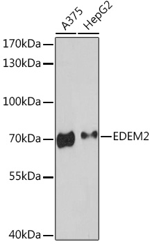 Western blot analysis of extracts of various cell lines, using EDEM2 Rabbit pAb (TA375710) at 1:3000 dilution. - Secondary antibody: HRP Goat Anti-Rabbit IgG (H+L) at 1:10000 dilution. - Lysates/proteins: 25ug per lane. - Blocking buffer: 3% nonfat dry milk in TBST. - Detection: ECL Enhanced Kit . - Exposure time: 90s.