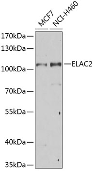 HEK293T cells were transfected with the pCMV6-ENTRY control (Left lane) or pCMV6-ENTRY CRP (RC217269, Right lane) cDNA for 48 hrs and lysed. Equivalent amounts of cell lysates (5 ug per lane) were separated by SDS-PAGE and immunoblotted with anti-CRP (1:2000).