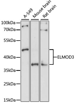 Western blot analysis of extracts of various cell lines, using ELMOD3 antibody (TA375866) at 1:1000 dilution. - Secondary antibody: HRP Goat Anti-Rabbit IgG (H+L) at 1:10000 dilution. - Lysates/proteins: 25ug per lane. - Blocking buffer: 3% nonfat dry milk in TBST. - Detection: ECL Basic Kit . - Exposure time: 90s.