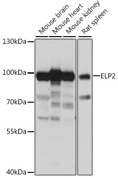 Western blot analysis of extracts of various cell lines, using ELP2 antibody (TA375870) at 1:1000 dilution. - Secondary antibody: HRP Goat Anti-Rabbit IgG (H+L) at 1:10000 dilution. - Lysates/proteins: 25ug per lane. - Blocking buffer: 3% nonfat dry milk in TBST. - Detection: ECL Basic Kit . - Exposure time: 1s.