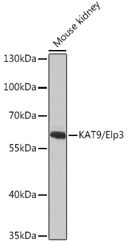 Western blot analysis of extracts of Mouse kidney, using KAT9/KAT9/Elp3 antibody (TA375871) at 1:1000 dilution. - Secondary antibody: HRP Goat Anti-Rabbit IgG (H+L) at 1:10000 dilution. - Lysates/proteins: 25ug per lane. - Blocking buffer: 3% nonfat dry milk in TBST. - Detection: ECL Basic Kit . - Exposure time: 120s.
