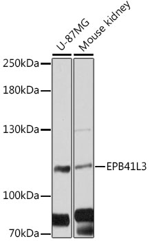 Western blot analysis of extracts of various cell lines, using EPB41L3 antibody (TA375920) at 1:3000 dilution. - Secondary antibody: HRP Goat Anti-Rabbit IgG (H+L) at 1:10000 dilution. - Lysates/proteins: 25ug per lane. - Blocking buffer: 3% nonfat dry milk in TBST. - Detection: ECL Basic Kit . - Exposure time: 30s.