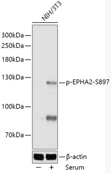 HEK293T cells were transfected with the pCMV6-ENTRY control (Left lane) or pCMV6-ENTRY PDCD1 (RC210364, Right lane) cDNA for 48 hrs and lysed. Equivalent amounts of cell lysates (5 ug per lane) were separated by SDS-PAGE and immunoblotted with anti-PDCD1. Positive lysates LY401555 (100 ug) and LC401555 (20 ug) can be purchased separately from OriGene.