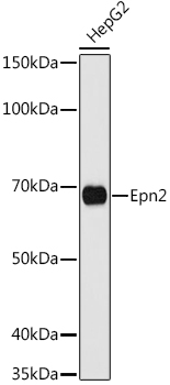 HEK293T cells were transfected with the pCMV6-ENTRY control (Left lane) or pCMV6-ENTRY PDCD1 (RC210364, Right lane) cDNA for 48 hrs and lysed. Equivalent amounts of cell lysates (5 ug per lane) were separated by SDS-PAGE and immunoblotted with anti-PDCD1 (1:2000).