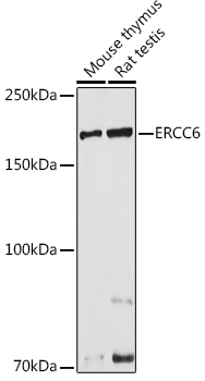 Western blot analysis of extracts of various cell lines, using ERCC6 antibody (TA375967) at 1:1000 dilution. - Secondary antibody: HRP Goat Anti-Rabbit IgG (H+L) at 1:10000 dilution. - Lysates/proteins: 25ug per lane. - Blocking buffer: 3% nonfat dry milk in TBST. - Detection: ECL Basic Kit . - Exposure time: 30s.
