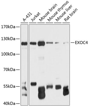 Western blot analysis of extracts of various cell lines, using EXOC4 antibody (TA376032) at 1:3000 dilution. - Secondary antibody: HRP Goat Anti-Rabbit IgG (H+L) at 1:10000 dilution. - Lysates/proteins: 25ug per lane. - Blocking buffer: 3% nonfat dry milk in TBST. - Detection: ECL Basic Kit . - Exposure time: 1s.