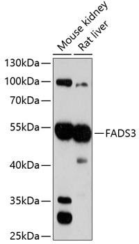 Western blot analysis of extracts of various cell lines, using FADS3 antibody (TA376080) at 1:3000 dilution. - Secondary antibody: HRP Goat Anti-Rabbit IgG (H+L) at 1:10000 dilution. - Lysates/proteins: 25ug per lane. - Blocking buffer: 3% nonfat dry milk in TBST. - Detection: ECL Basic Kit . - Exposure time: 90s.
