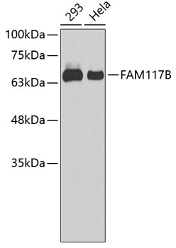 Western blot analysis of extracts of various cell lines, using FAM117B antibody (TA376091). - Secondary antibody: HRP Goat Anti-Rabbit IgG (H+L) at 1:10000 dilution. - Lysates/proteins: 25ug per lane. - Blocking buffer: 3% nonfat dry milk in TBST.