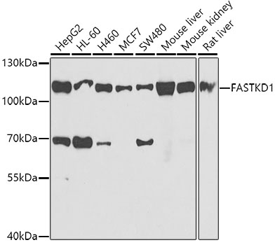 Western blot analysis of extracts of various cell lines, using FASTKD1 antibody (TA376135) at 1:1000 dilution. - Secondary antibody: HRP Goat Anti-Rabbit IgG (H+L) at 1:10000 dilution. - Lysates/proteins: 25ug per lane. - Blocking buffer: 3% nonfat dry milk in TBST. - Detection: ECL Basic Kit . - Exposure time: 90s.