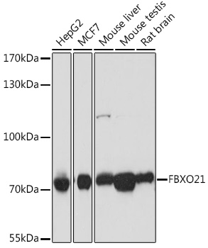 Western blot analysis of extracts of various cell lines, using FBXO21 antibody (TA376155) at 1:1000 dilution. - Secondary antibody: HRP Goat Anti-Rabbit IgG (H+L) at 1:10000 dilution. - Lysates/proteins: 25ug per lane. - Blocking buffer: 3% nonfat dry milk in TBST. - Detection: ECL Basic Kit . - Exposure time: 1s.