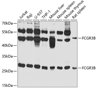 Western blot analysis of extracts of various cell lines, using FCGR3B antibody (TA376186) at 1:1000 dilution._Secondary antibody: HRP Goat Anti-Rabbit IgG (H+L) at 1:10000 dilution._Lysates/proteins: 25ug per lane._Blocking buffer: 3% nonfat dry milk in TBST._Detection: ECL Enhanced Kit ._Exposure time: 60s.