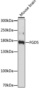 Western blot analysis of extracts of Mouse brain, using FGD5 antibody (TA376217) at 1:1000 dilution. - Secondary antibody: HRP Goat Anti-Rabbit IgG (H+L) at 1:10000 dilution. - Lysates/proteins: 25ug per lane. - Blocking buffer: 3% nonfat dry milk in TBST. - Detection: ECL Basic Kit . - Exposure time: 60s.