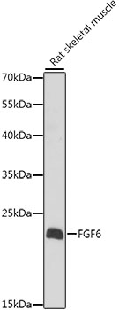 Western blot analysis of extracts of Rat skeletal muscle, using FGF6 antibody (TA376232) at 1:1000 dilution. - Secondary antibody: HRP Goat Anti-Rabbit IgG (H+L) at 1:10000 dilution. - Lysates/proteins: 25ug per lane. - Blocking buffer: 3% nonfat dry milk in TBST. - Detection: ECL Basic Kit . - Exposure time: 30s.