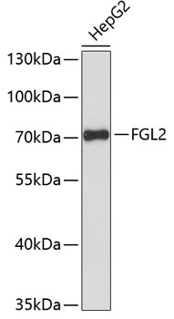HEK293T cells were transfected with the pCMV6-ENTRY control (Cat# PS100001, Left lane) or pCMV6-ENTRY SRSF9 (Cat# RC210898, Right lane) cDNA for 48 hrs and lysed. Equivalent amounts of cell lysates (5 ug per lane) were separated by SDS-PAGE and immunoblotted with anti-SRSF9 (Cat# TA808424)(1:2000). Positive lysates [LY418444] (100 ug) and [LC418444] (20 ug) can be purchased separately from OriGene.