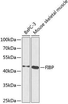 Western blot analysis of extracts of various cell lines, using FIBP antibody (TA376250) at 1:1000 dilution. - Secondary antibody: HRP Goat Anti-Rabbit IgG (H+L) at 1:10000 dilution. - Lysates/proteins: 25ug per lane. - Blocking buffer: 3% nonfat dry milk in TBST. - Detection: ECL Basic Kit . - Exposure time: 90s.
