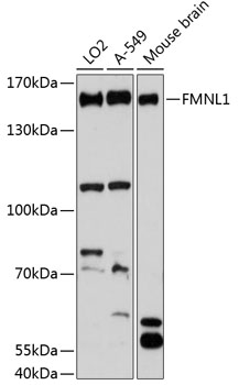 Western blot analysis of extracts of various cell lines, using FMNL1 antibody (TA376294) at 1:3000 dilution. - Secondary antibody: HRP Goat Anti-Rabbit IgG (H+L) at 1:10000 dilution. - Lysates/proteins: 25ug per lane. - Blocking buffer: 3% nonfat dry milk in TBST. - Detection: ECL Basic Kit . - Exposure time: 90s.