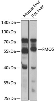 Equivalent amounts of cell lysates (10 ug per lane) of wild-type Hela cells (WT, Cat# LC810HELA) and TDG-Knockout Hela cells (KO, Cat# LC810235) were separated by SDS-PAGE and immunoblotted with anti-TDG monoclonal antibody TA808511, (1:500). Then the blotted membrane was stripped and reprobed with anti-b-actin antibody (TA811000) as a loading control.