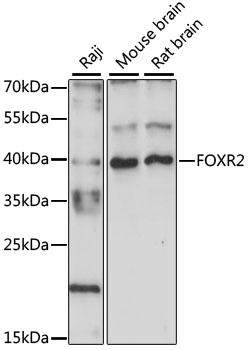 Western blot analysis of extracts of various cell lines, using FOXR2 antibody (TA376349) at 1:1000 dilution. - Secondary antibody: HRP Goat Anti-Rabbit IgG (H+L) at 1:10000 dilution. - Lysates/proteins: 25ug per lane. - Blocking buffer: 3% nonfat dry milk in TBST. - Detection: ECL Basic Kit . - Exposure time: 90s.