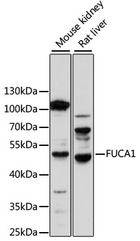 HEK293T cells were transfected with the pCMV6-ENTRY control (Cat# PS100001, Left lane) or pCMV6-ENTRY TDG (Cat# RC207113, Right lane) cDNA for 48 hrs and lysed. Equivalent amounts of cell lysates (5 ug per lane) were separated by SDS-PAGE and immunoblotted with anti-TDG (Cat# TA808610)(1:2000). Positive lysates [LY401109] (100 ug) and [LC401109] (20 ug) can be purchased separately from OriGene.