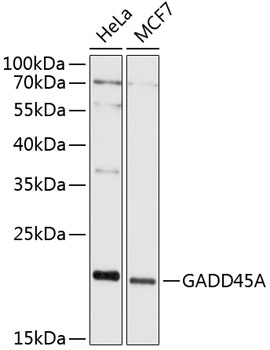 Western blot analysis of extracts of various cell lines, using GADD45A antibody (TA376457) at 1:1000 dilution. - Secondary antibody: HRP Goat Anti-Rabbit IgG (H+L) at 1:10000 dilution. - Lysates/proteins: 25ug per lane. - Blocking buffer: 3% nonfat dry milk in TBST. - Detection: ECL Basic Kit . - Exposure time: 1s.