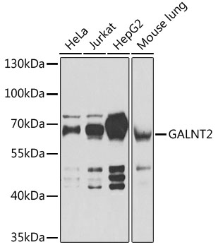 Western blot analysis of extracts of various cell lines, using GALNT2 antibody (TA376467) at 1:1000 dilution. - Secondary antibody: HRP Goat Anti-Rabbit IgG (H+L) at 1:10000 dilution. - Lysates/proteins: 25ug per lane. - Blocking buffer: 3% nonfat dry milk in TBST. - Detection: ECL Basic Kit . - Exposure time: 1s.