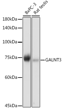 Western blot analysis of extracts of various cell lines, using GALNT3 antibody (TA376468) at 1:1000 dilution. - Secondary antibody: HRP Goat Anti-Rabbit IgG (H+L) at 1:10000 dilution. - Lysates/proteins: 25ug per lane. - Blocking buffer: 3% nonfat dry milk in TBST. - Detection: ECL Basic Kit . - Exposure time: 1s.