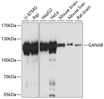 Western blot analysis of extracts of various cell lines, using GANAB antibody (TA376476) at 1:3000 dilution. - Secondary antibody: HRP Goat Anti-Rabbit IgG (H+L) at 1:10000 dilution. - Lysates/proteins: 25ug per lane. - Blocking buffer: 3% nonfat dry milk in TBST. - Detection: ECL Basic Kit . - Exposure time: 10s.