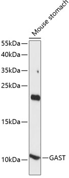 Western blot analysis of extracts of mouse stomach, using GAST antibody (TA376488) at 1:1000 dilution. - Secondary antibody: HRP Goat Anti-Rabbit IgG (H+L) at 1:10000 dilution. - Lysates/proteins: 25ug per lane. - Blocking buffer: 3% nonfat dry milk in TBST. - Detection: ECL Basic Kit . - Exposure time: 90s.