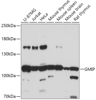 Western blot analysis of extracts of various cell lines, using GMIP antibody (TA376624) at 1:1000 dilution. - Secondary antibody: HRP Goat Anti-Rabbit IgG (H+L) at 1:10000 dilution. - Lysates/proteins: 25ug per lane. - Blocking buffer: 3% nonfat dry milk in TBST. - Detection: ECL Basic Kit . - Exposure time: 30s.