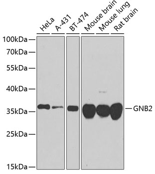 HEK293T cells were transfected with the pCMV6-ENTRY control (Left lane) or pCMV6-ENTRY NPPB (RC206590, Right lane) cDNA for 48 hrs and lysed. Equivalent amounts of cell lysates (5 ug per lane) were separated by SDS-PAGE and immunoblotted with anti-NPPB (1:2000). Positive lysates LY400900 (100 ug) and LC400900 (20 ug) can be purchased separately from OriGene.